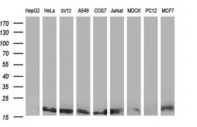 NME2 Antibody in Western Blot (WB)