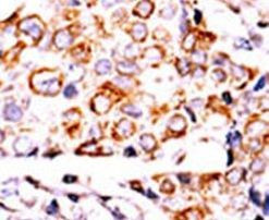NME3 Antibody in Immunohistochemistry (IHC)