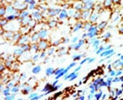 NME4 Antibody in Immunohistochemistry (IHC)