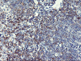 NMT2 Antibody in Immunohistochemistry (Paraffin) (IHC (P))