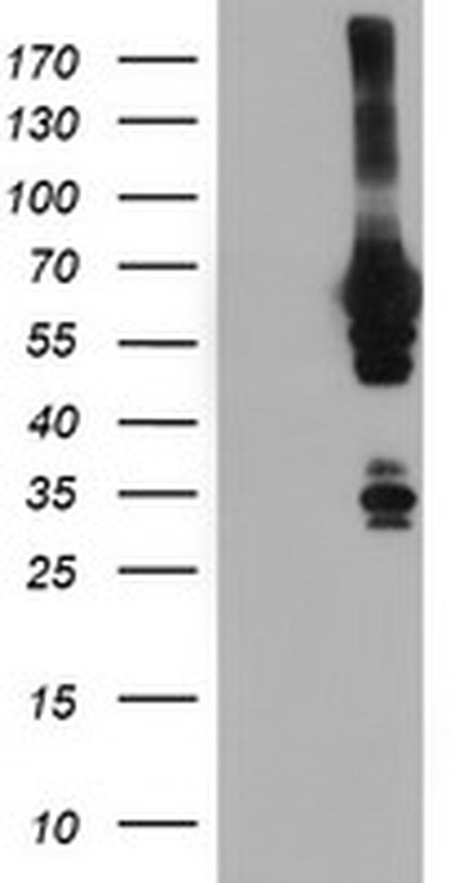 NMT2 Antibody in Western Blot (WB)
