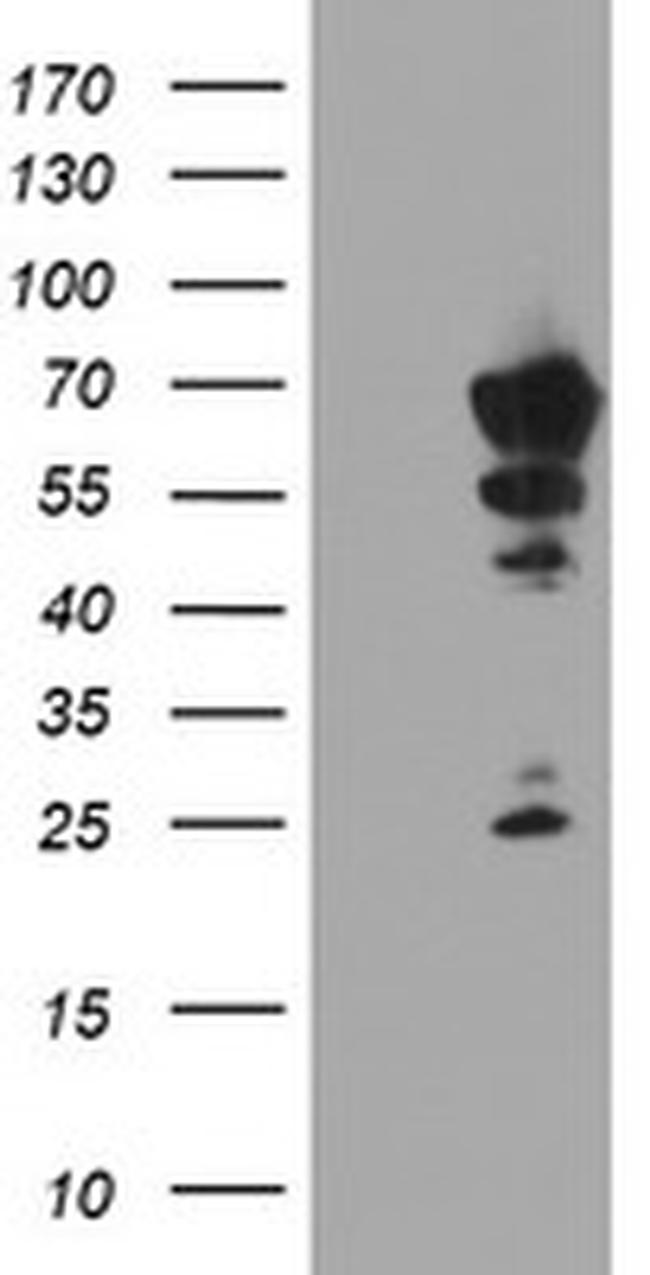 NMT2 Antibody in Western Blot (WB)