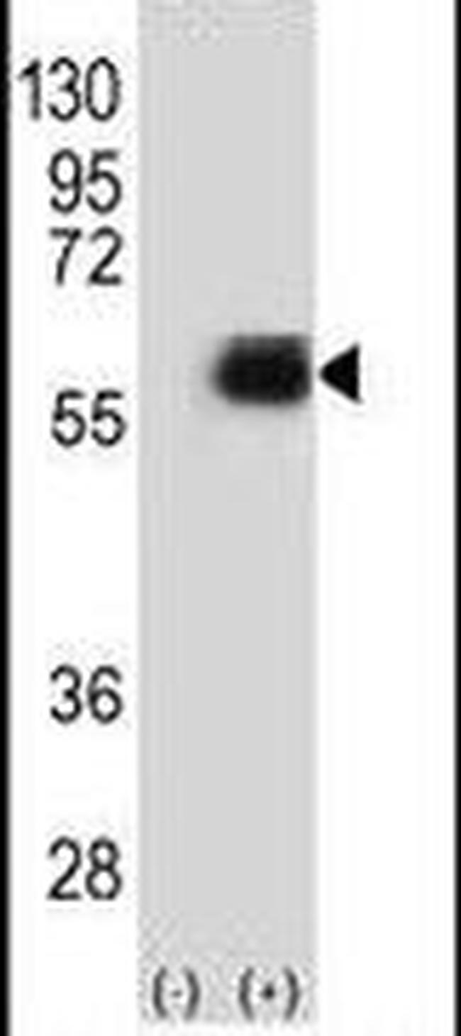NMT2 Antibody in Western Blot (WB)