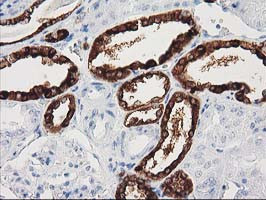 NNMT Antibody in Immunohistochemistry (Paraffin) (IHC (P))