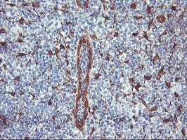 NNMT Antibody in Immunohistochemistry (Paraffin) (IHC (P))