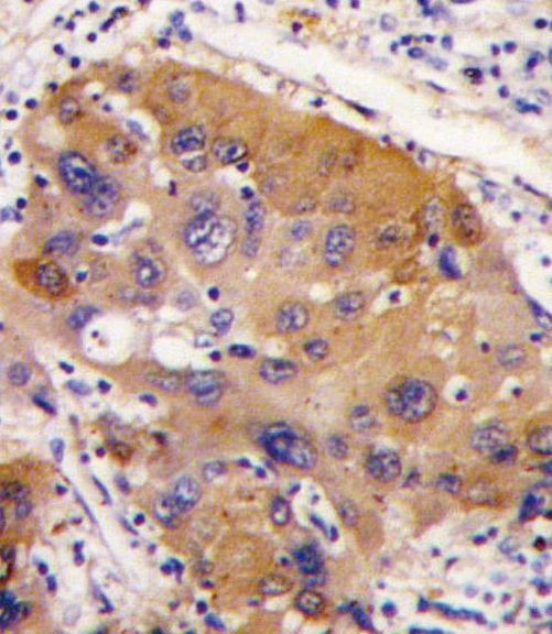 NNMT Antibody in Immunohistochemistry (IHC)