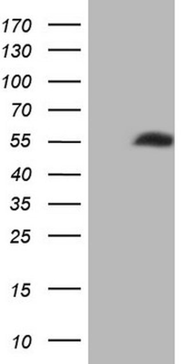 NOB1 Antibody in Western Blot (WB)