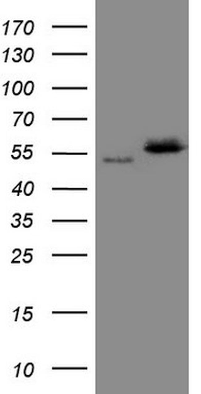 NOB1 Antibody in Western Blot (WB)