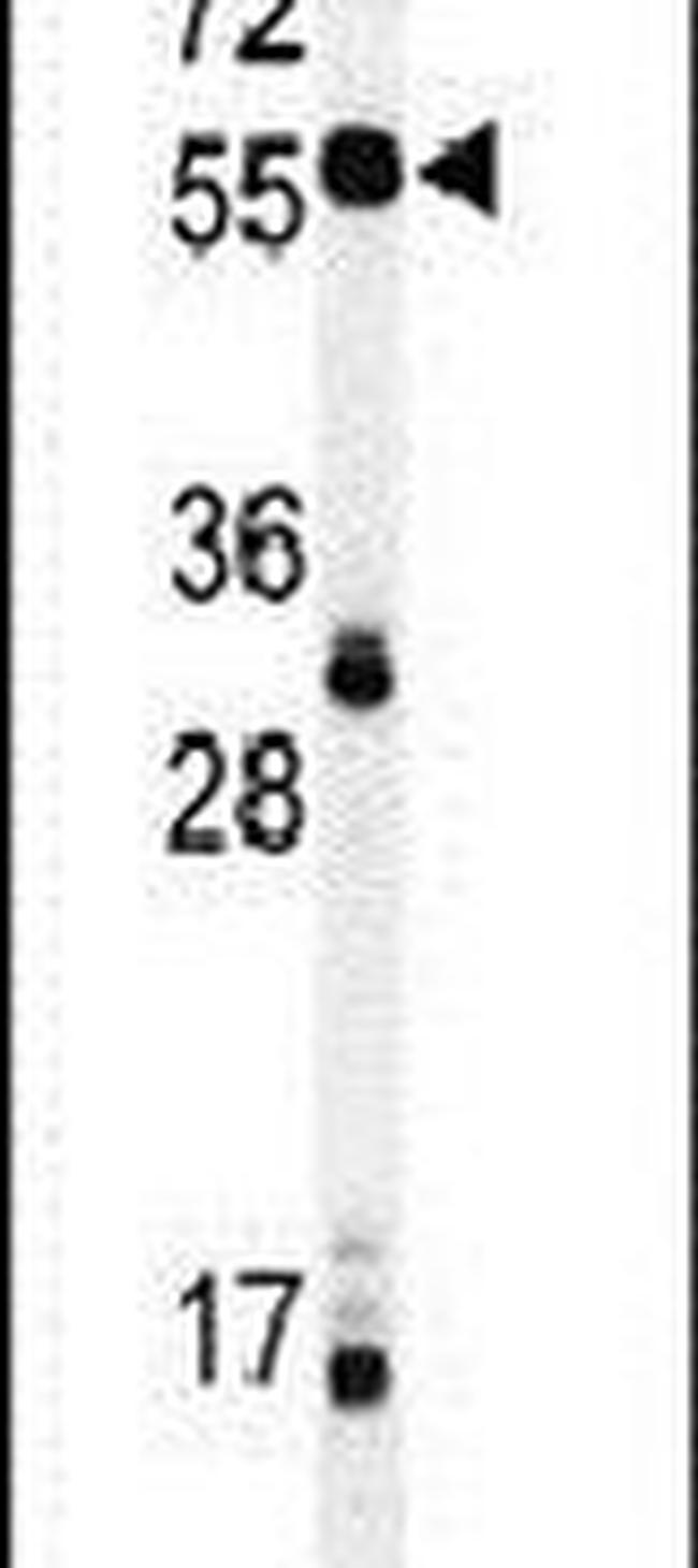 NOB1 Antibody in Western Blot (WB)