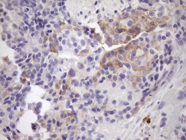 NOBOX Antibody in Immunohistochemistry (Paraffin) (IHC (P))