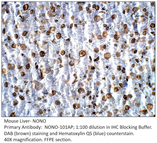 nmt55/NONO/p54nrb Antibody in Immunohistochemistry (IHC)