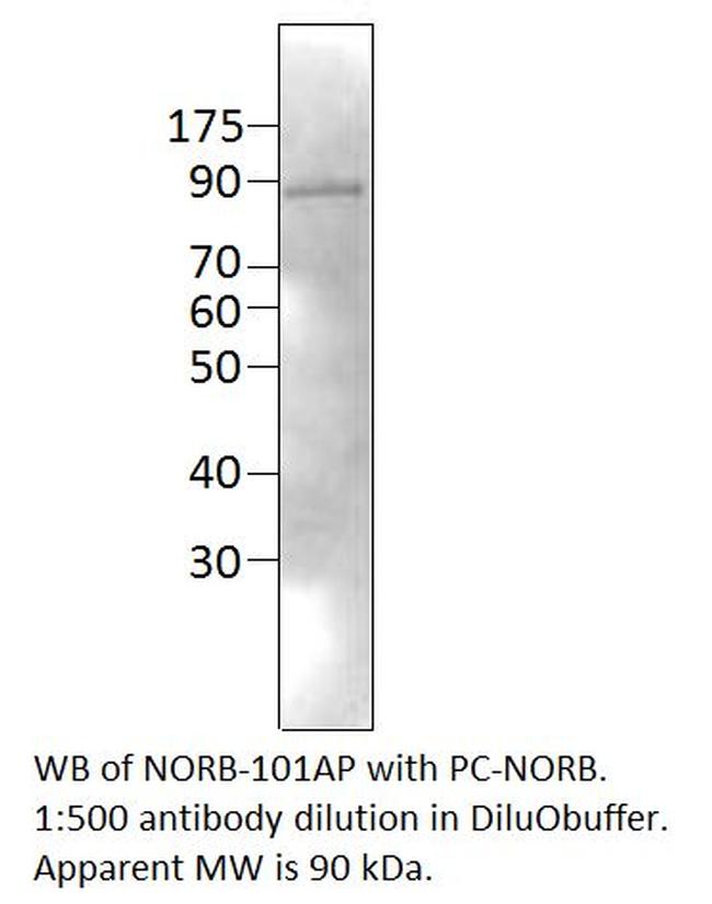 Neurochondrin Antibody in Western Blot (WB)
