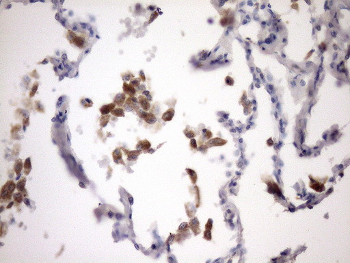 NOTCH1 Antibody in Immunohistochemistry (Paraffin) (IHC (P))