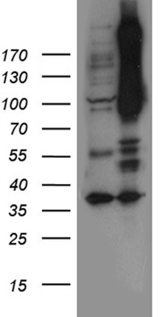 NOTCH4 Antibody in Western Blot (WB)