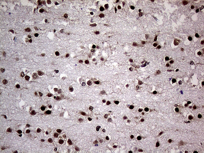 NPAS1 Antibody in Immunohistochemistry (Paraffin) (IHC (P))