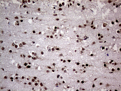 NPAS1 Antibody in Immunohistochemistry (Paraffin) (IHC (P))