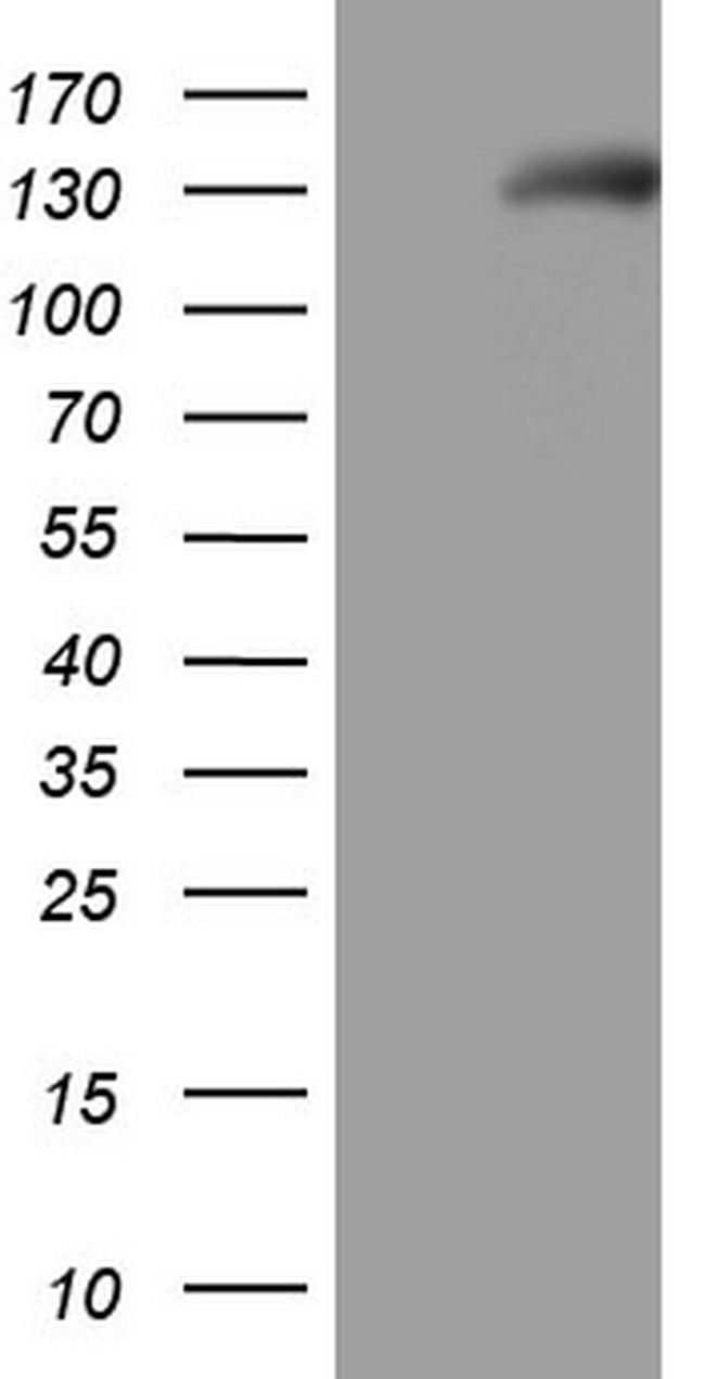 NPR1 Antibody in Western Blot (WB)