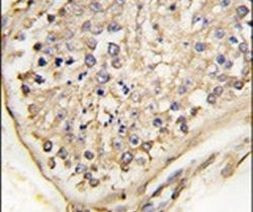 NPTX2 Antibody in Immunohistochemistry (IHC)