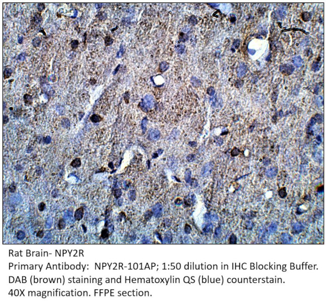 NPY2R Antibody in Immunohistochemistry (IHC)