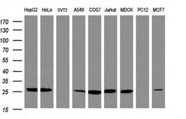NQO2 Antibody in Western Blot (WB)