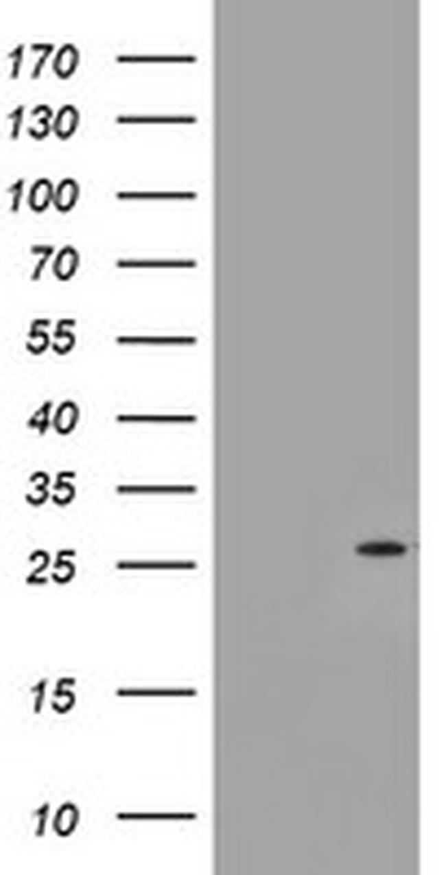 NQO2 Antibody in Western Blot (WB)