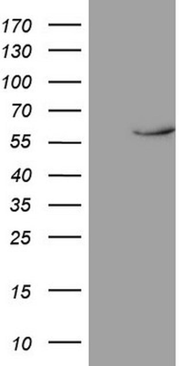 NR1D2 Antibody in Western Blot (WB)