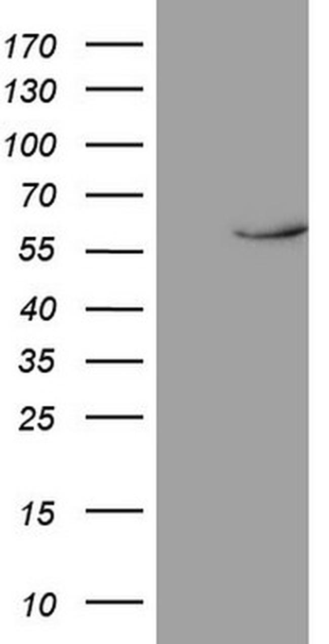 NR1D2 Antibody in Western Blot (WB)