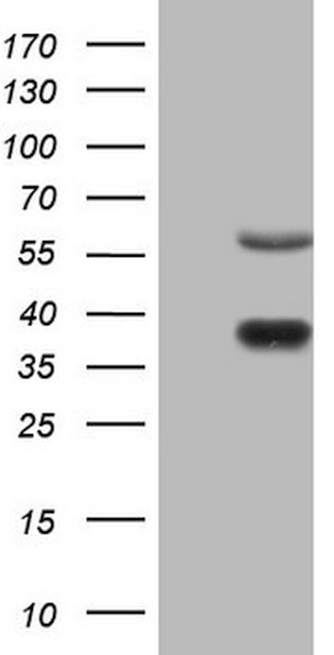 NR1D2 Antibody in Western Blot (WB)