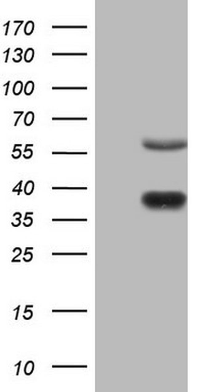 NR1D2 Antibody in Western Blot (WB)