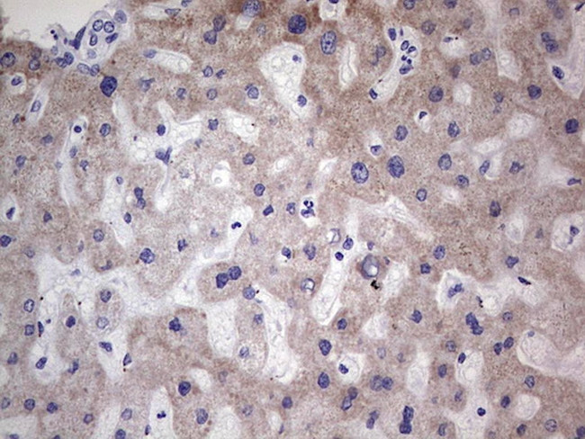 NR1I3 Antibody in Immunohistochemistry (Paraffin) (IHC (P))
