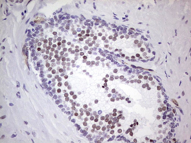 NR1I3 Antibody in Immunohistochemistry (Paraffin) (IHC (P))
