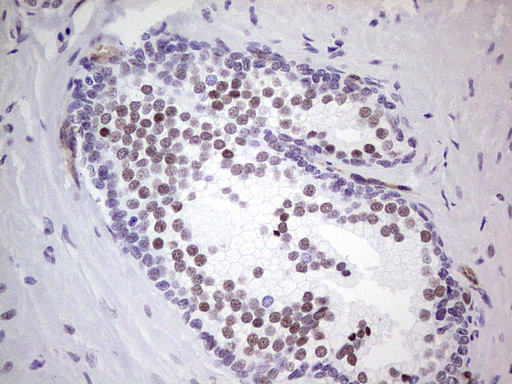NR1I3 Antibody in Immunohistochemistry (Paraffin) (IHC (P))