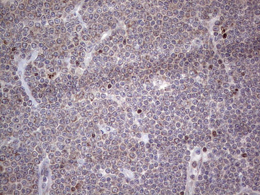 NR1I3 Antibody in Immunohistochemistry (Paraffin) (IHC (P))