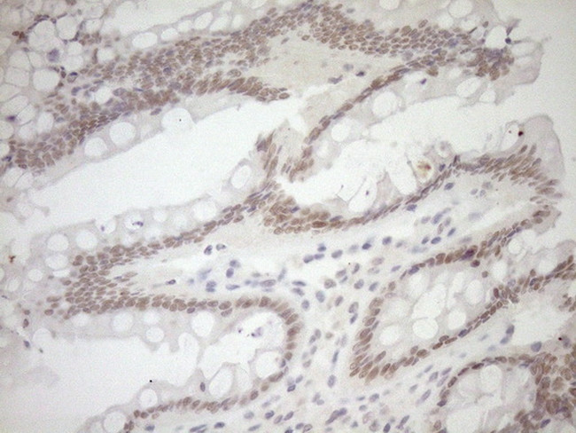 NR1I3 Antibody in Immunohistochemistry (Paraffin) (IHC (P))
