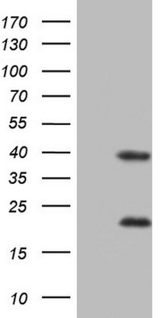 NR1I3 Antibody in Western Blot (WB)
