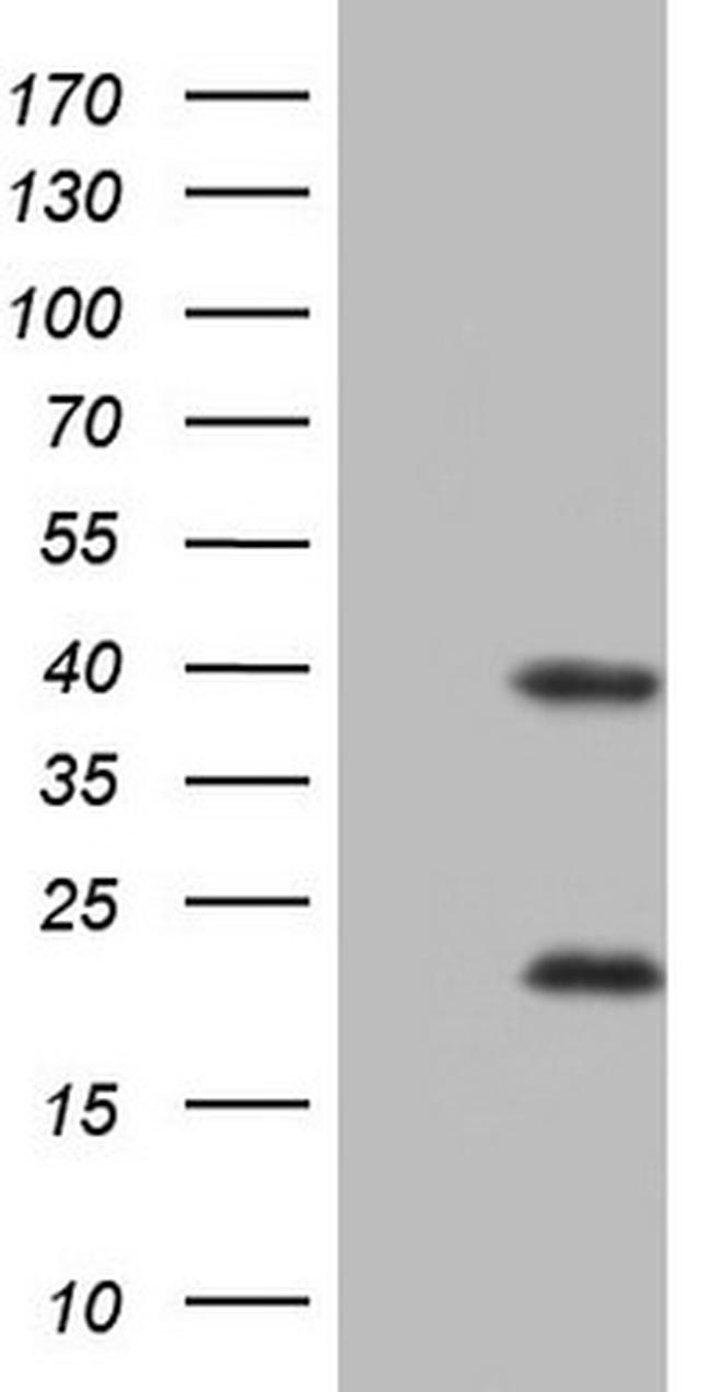 NR1I3 Antibody in Western Blot (WB)