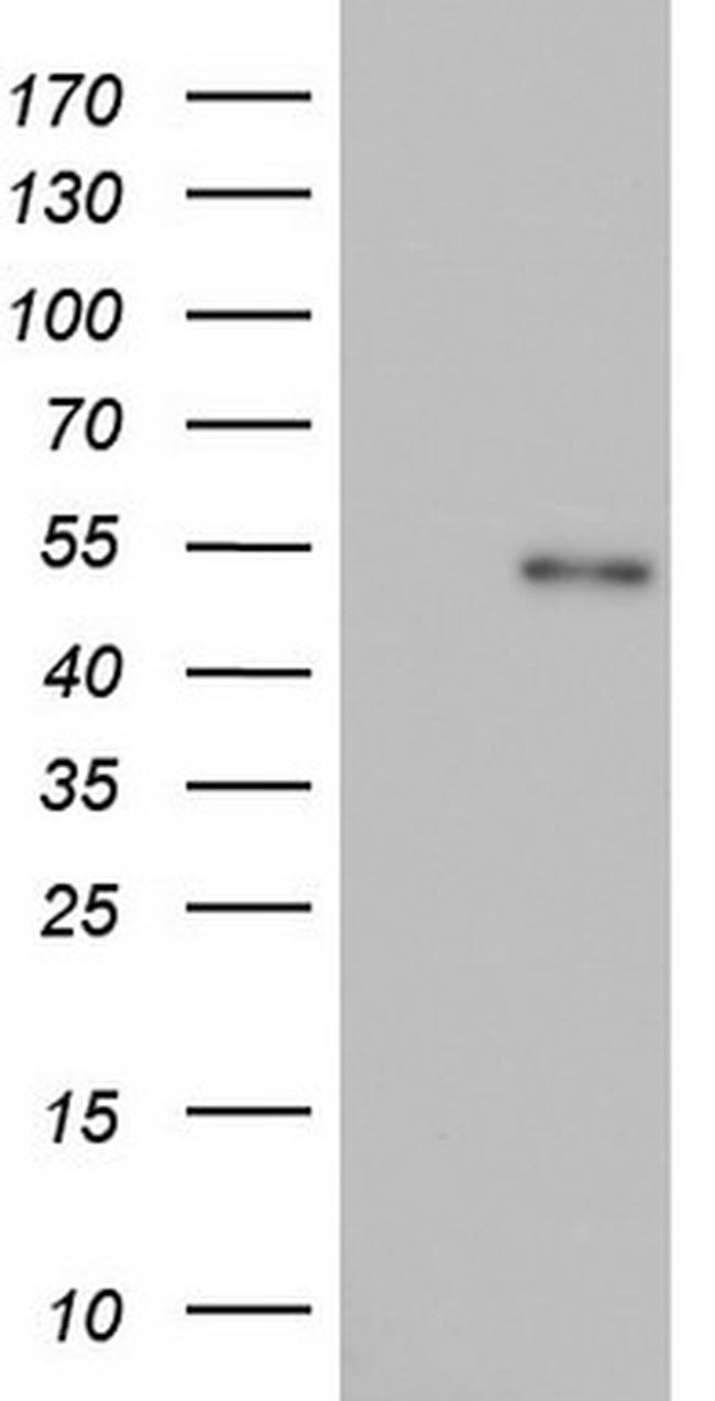 NR2C1 Antibody in Western Blot (WB)