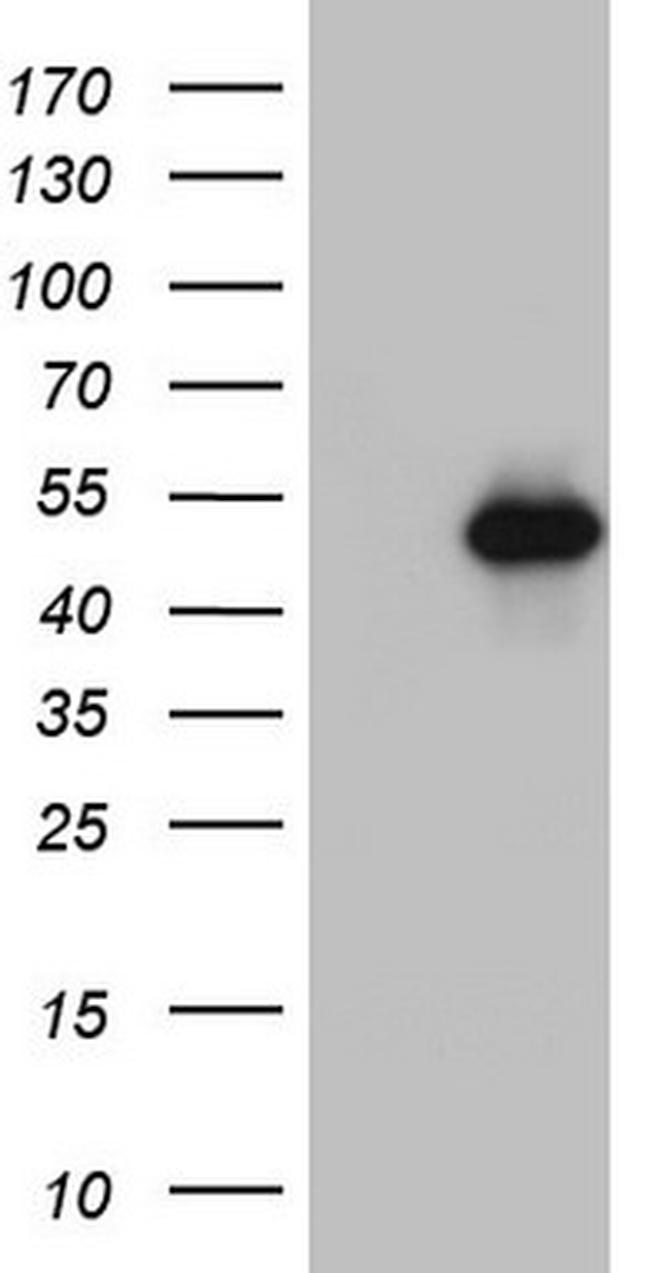 NR2C1 Antibody in Western Blot (WB)