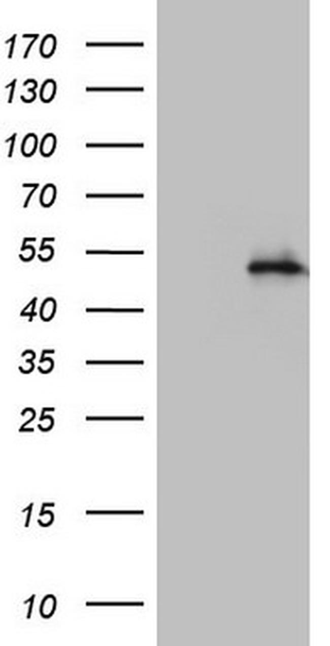NR2C1 Antibody in Western Blot (WB)