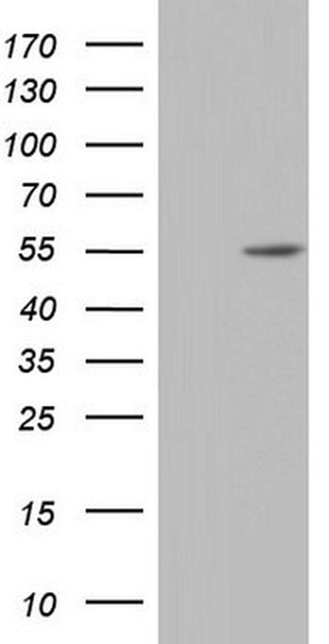 NR2C1 Antibody in Western Blot (WB)