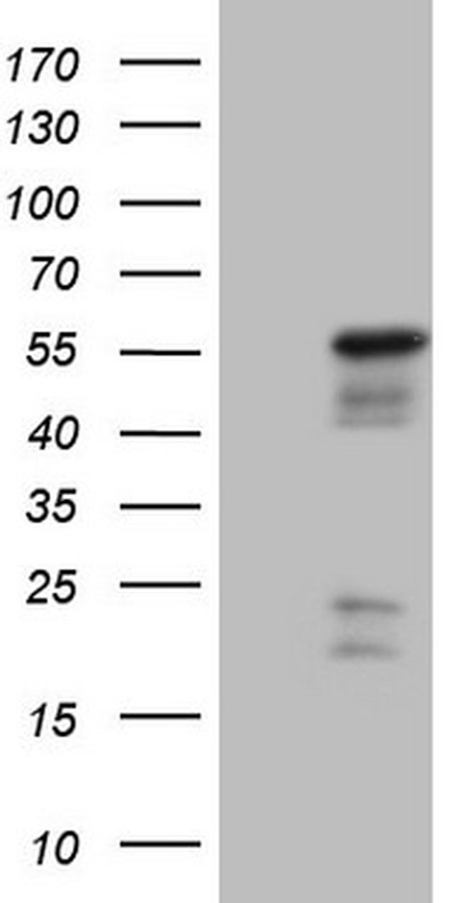 NR2E3 Antibody in Western Blot (WB)