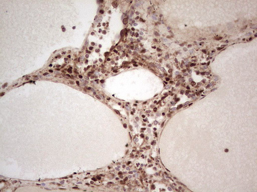 NR3C1 Antibody in Immunohistochemistry (Paraffin) (IHC (P))