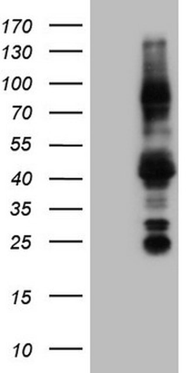 NR3C1 Antibody in Western Blot (WB)