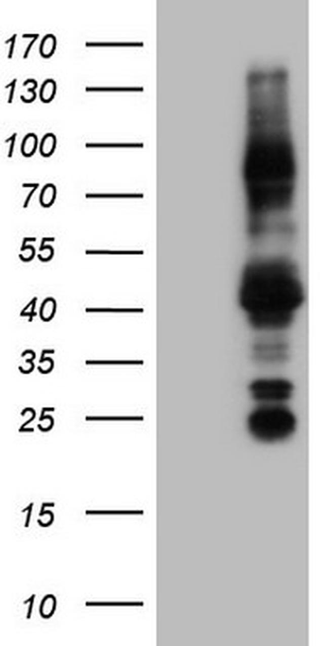 NR3C1 Antibody in Western Blot (WB)