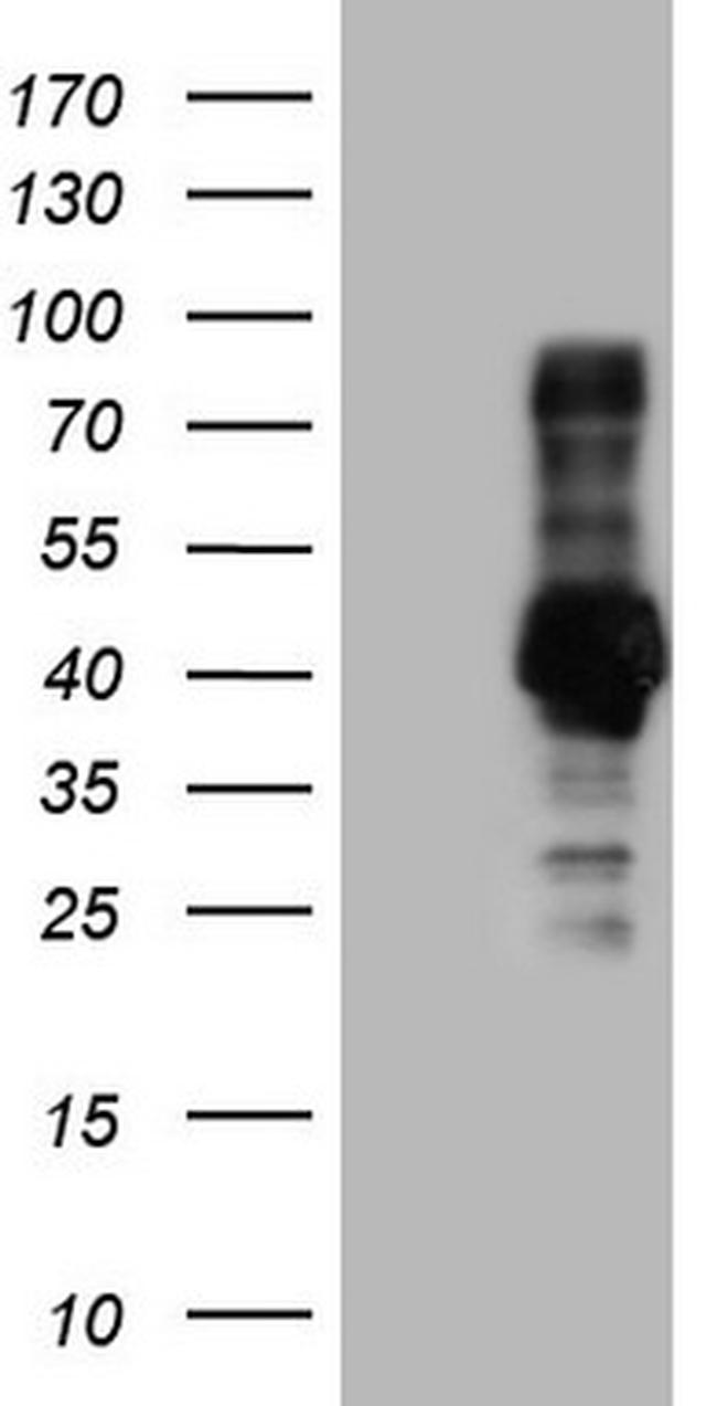 NR3C1 Antibody in Western Blot (WB)