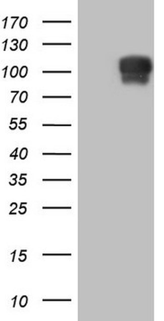 NR3C1 Antibody in Western Blot (WB)