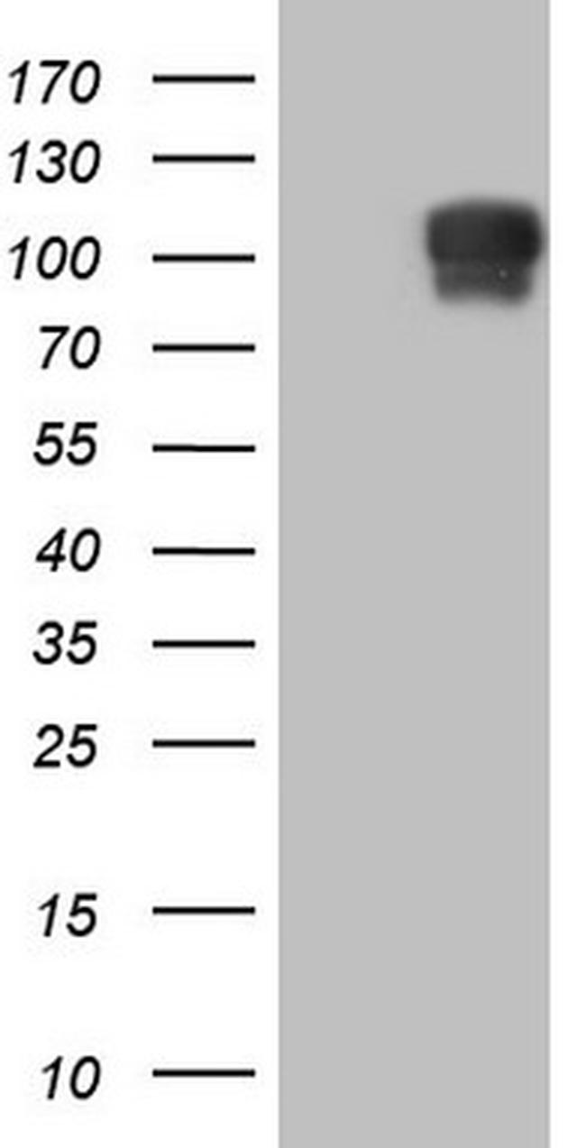 NR3C1 Antibody in Western Blot (WB)