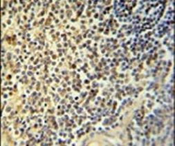 NR5A1 Antibody in Immunohistochemistry (IHC)