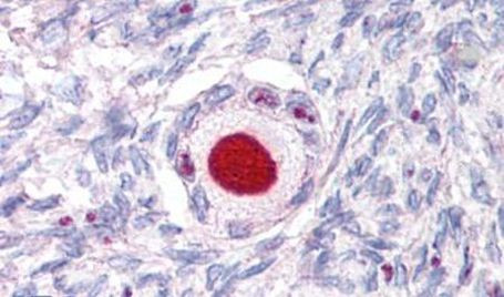 NR5A1 Antibody in Immunohistochemistry (Paraffin) (IHC (P))