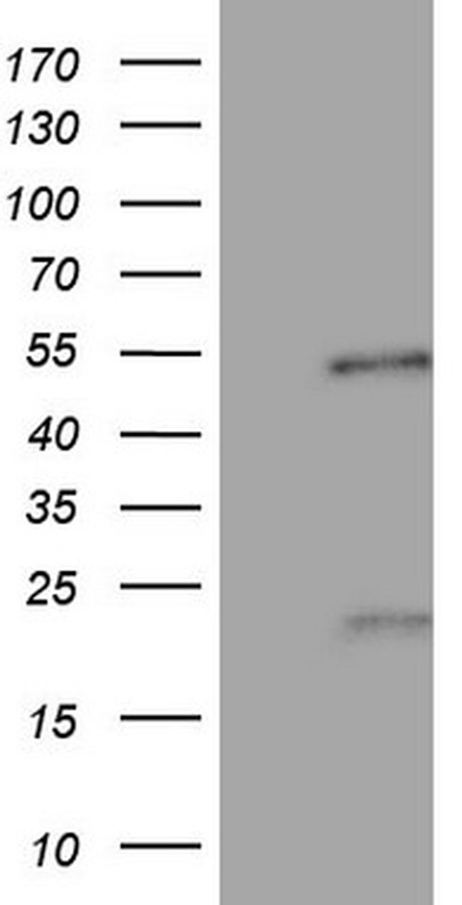 NR5A1 Antibody in Western Blot (WB)